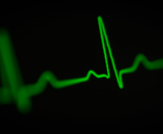 Heart attack care trial decision deferred