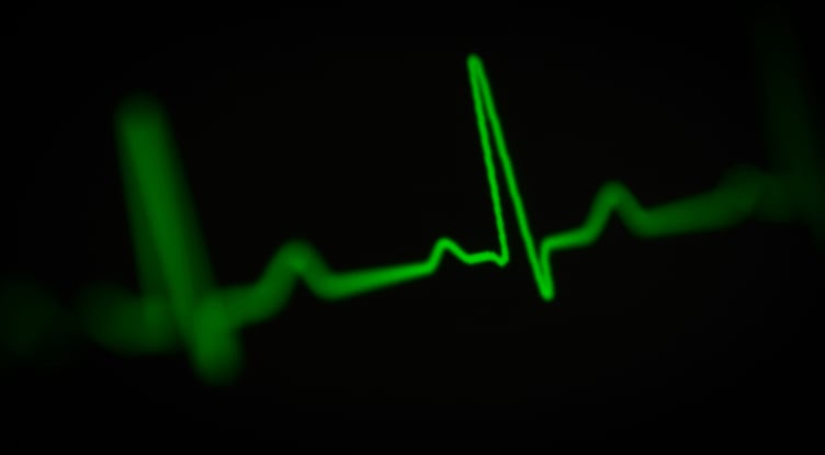 Heart monitor. Photo Unsplash